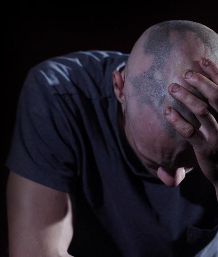 All You Need To Know About Alopecia Areata & Hair Loss